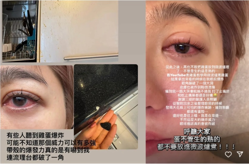 王晴 微波爐
