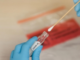 期待新冠疫苗上市恢復正常生活？佛奇：廣泛使用要等2021年幾個月後