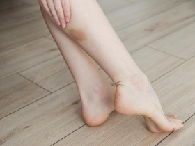 手腳小傷口難癒合，有這4種情況發生，當心變蜂窩性組織炎