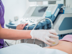 巧克力囊腫最常見 畸胎瘤防惡化　卵巢囊腫良性居多 這一刀別亂動