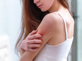 疫情壓力大，慢性蕁麻疹患者心酸誰人知！醫師：掌握5不3要，真正緩解過敏症狀