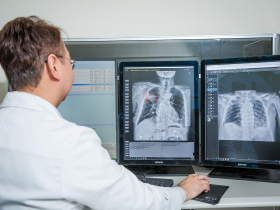 「120元基本心電圖，就可抓出未來1~3年死亡機率！」 長庚、榮總到台大都擁抱AI　不只急診救命　更能找出心臟危機