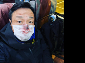 PCR會流鼻血？陳志金醫師：剛下飛機「這原因」是關鍵！批王喜連發20文「想搞獵巫鬥爭」？