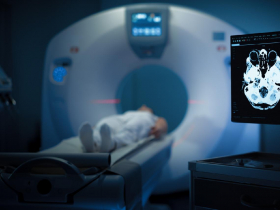 61歲阿伯戴金屬項鍊，被吸入MRI機器慘死！檢查結束也有強大磁力？一條項鍊有這麼可怕？進檢查室要注意的事