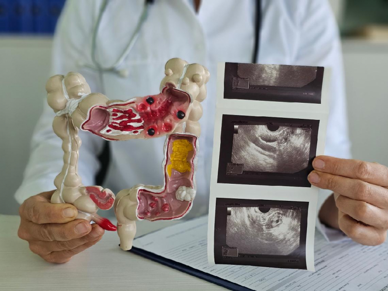 照大腸鏡切除息肉，沒寫「經直腸」不理賠？外科醫師帶你看懂「診斷書」眉角：226和227差在哪？