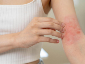 魂魄泡水裡才會「皮膚爛」？她求根治皮膚炎竟花百萬放血、捐棺…醫揭治療迷思與真相：別走冤枉路