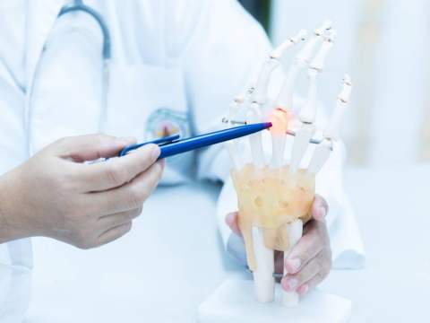 不是牛奶，「骨頭守護神」是它！8問題自我檢測「骨質疏鬆了嗎」...骨科名醫教2個動作逆轉骨齡