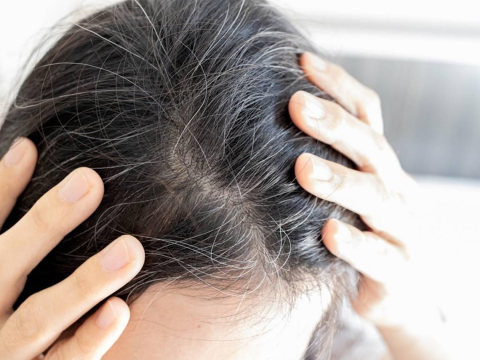 白頭髮能黑回來？營養師激推「1堅果」是對抗白髮的天然保健品：這樣吃，黑髮更快長出來