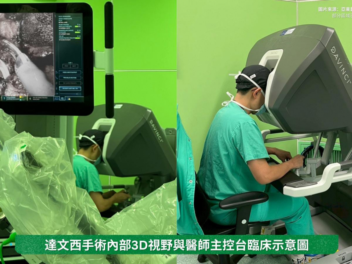 該選擇達文西手術嗎？亞東醫院許志豪醫師解析三大判斷點 微創手術怎麼選？疝氣、膽囊、腫瘤手術的方式比較、費用與保險一次看懂
