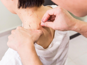 中醫師臨床經驗觀察  刺激穴位展現正向作用　針灸、電針並用療法  可輔助抗癌