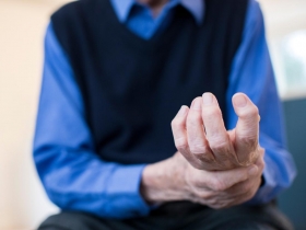 血液不流通  關節易膨脹  保暖才是王道 類風溼性關節炎慎防「冷天痛」