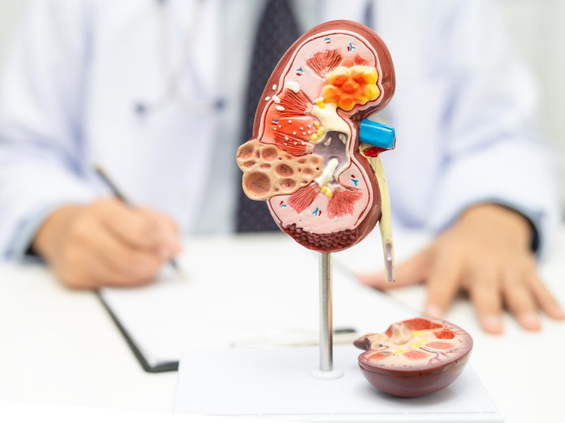 50歲後小腿太細是災難！肌少症洗腎風險多1倍，醫曝「傷腎瘦」恐怖真相：別再晚餐才吃肉、散步不能長肌肉