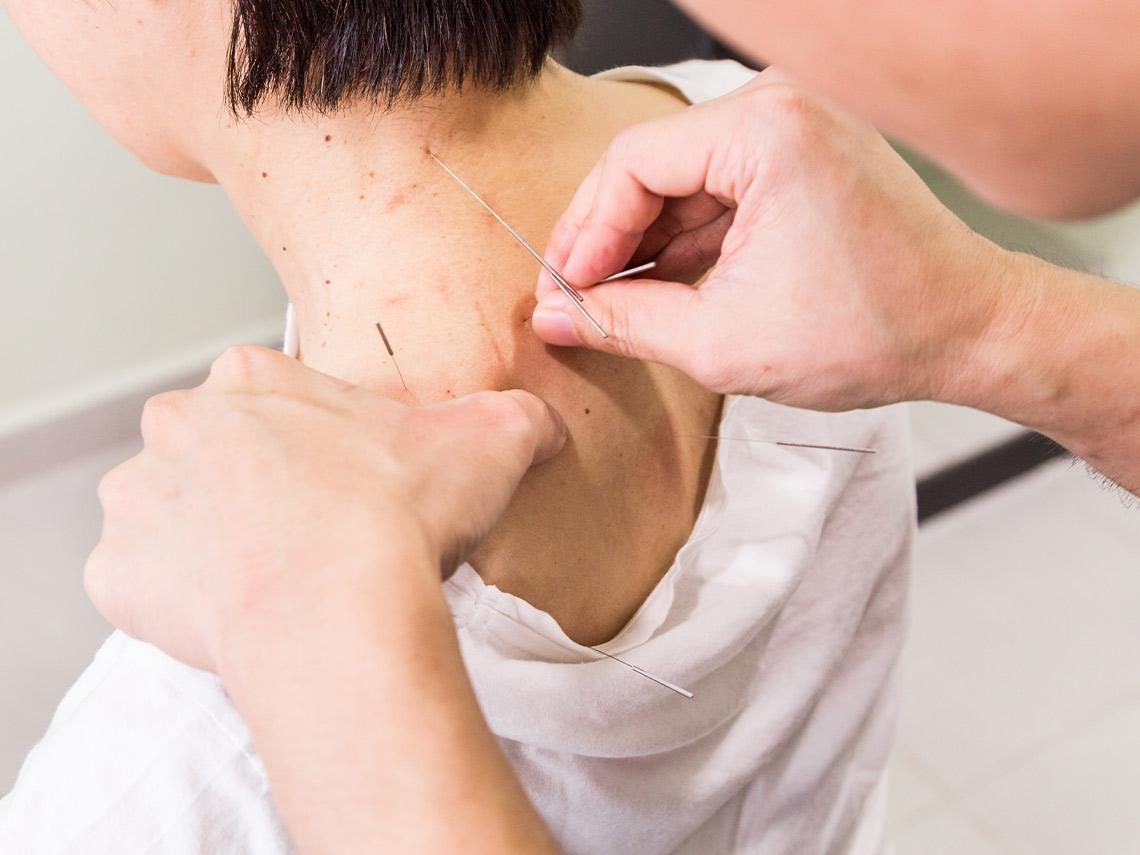 提升自理能力⋯把握發病六個月內的「黃金修復期」   改善腦中風後遺症  針灸成好幫手