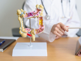 一天3個病人都「大息肉」，醫師幫切除：不敢再吃這3種食物！健檢2關鍵「無大腸癌家族史也要小心」