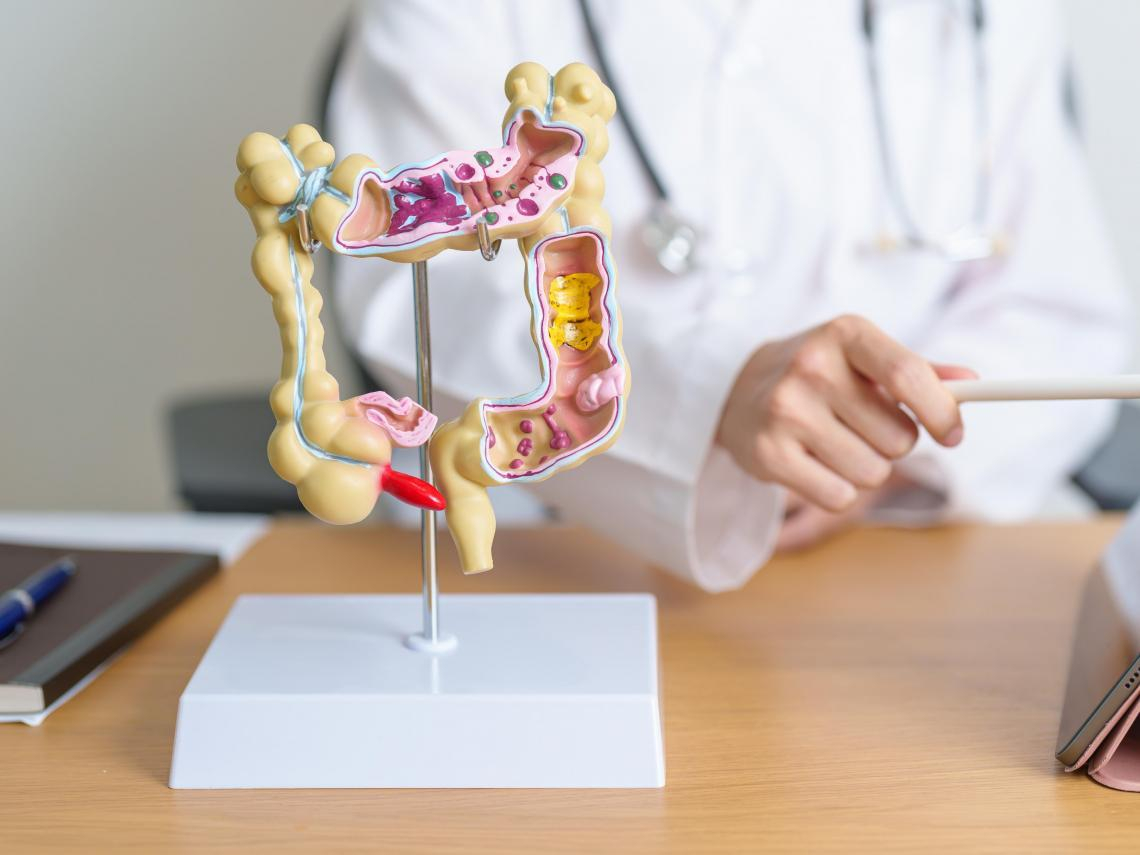 18歲竟罹大腸癌三期！年輕人確診比長輩多拖128天理由曝光…醫揭2個常忽略症狀：壞細胞這時最叛逆