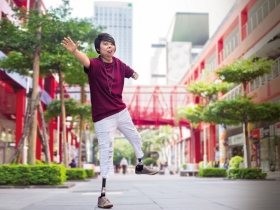 生命鬥士》她，14 歲遇火劫，失去雙腳、左臂，幾乎毀容……  鋼鐵女孩莊雅菁：接納不完美 才能看見自己的價值