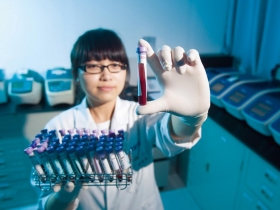 對抗闇黑癌症  新療法也難掛保證 儲存免疫細胞  未必能救命