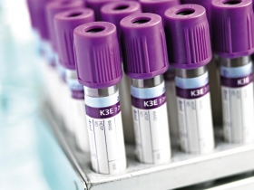 抽血驗癌不能判定罹癌