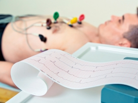 心跳異常難發現  留意胸悶、頭暈示警