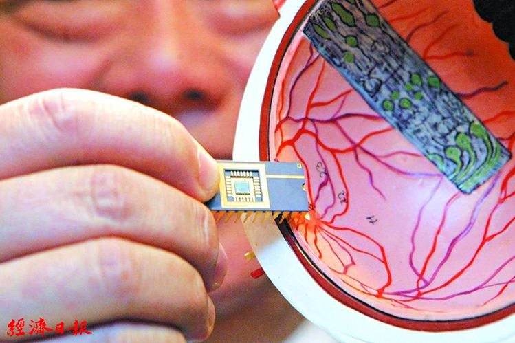 你準備好沒？業者預言20年內將實現人體植入晶片