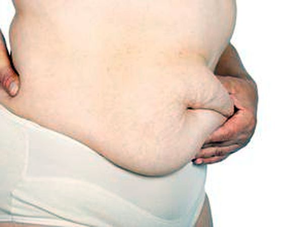 一兼二顧！　減重手術治第二型糖尿病