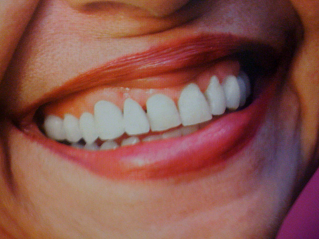 拔與不拔？ 談智齒的迷思