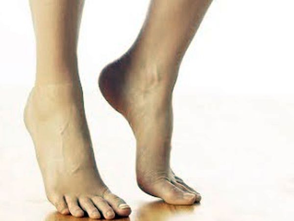 過年採買腳跟痛　足底筋膜炎作祟