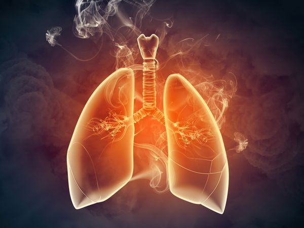 空汙問題日益嚴重　預防防治雙管齊下