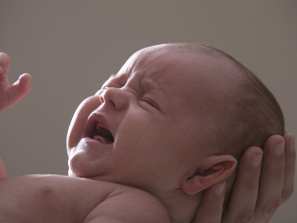 血管瘤別輕忽　卡莎巴梅症候群會要命