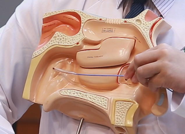 耳外無縫線、無傷口─內視鏡耳膜修補手術