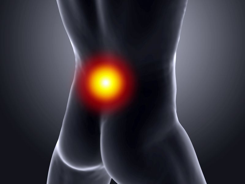 走路臀腿莫名疼痛　梨狀肌症候群惹禍