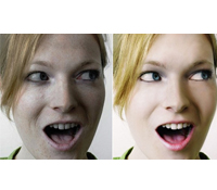 入春冷熱溫差大 蕁麻疹發癢難耐