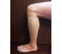 季節交替好發膽結石,中醫保健治療齊下擋劇痛