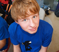 臉部外傷恐致鼻子歪斜 外科手術可重建