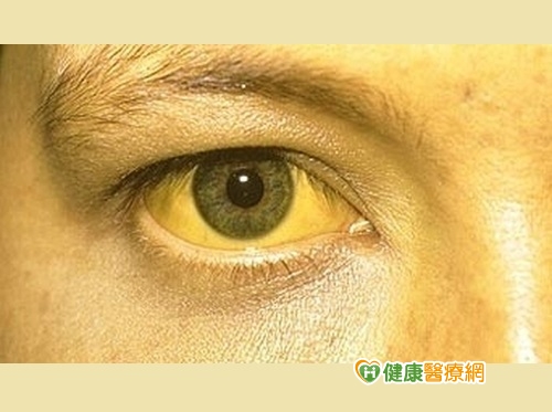 亂用肝癌偏方 皮膚變青綠色如綠巨人！