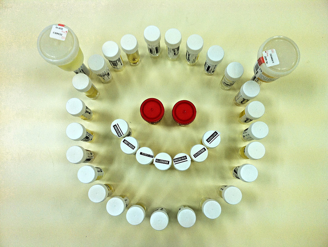 泡泡尿原因多 應以尿液分析為準