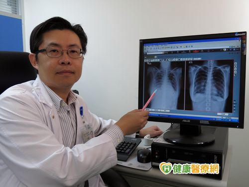 流感+金黃色葡萄球菌　恐引起肺炎