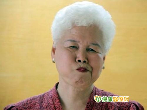 老人咀嚼功能退化　健口操可預防