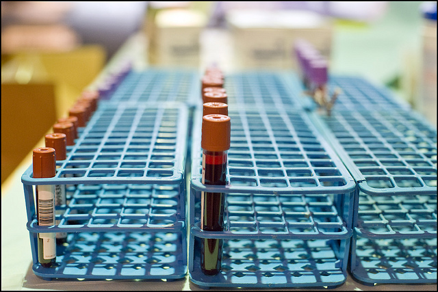 急性淋巴性白血病 近8成可治癒