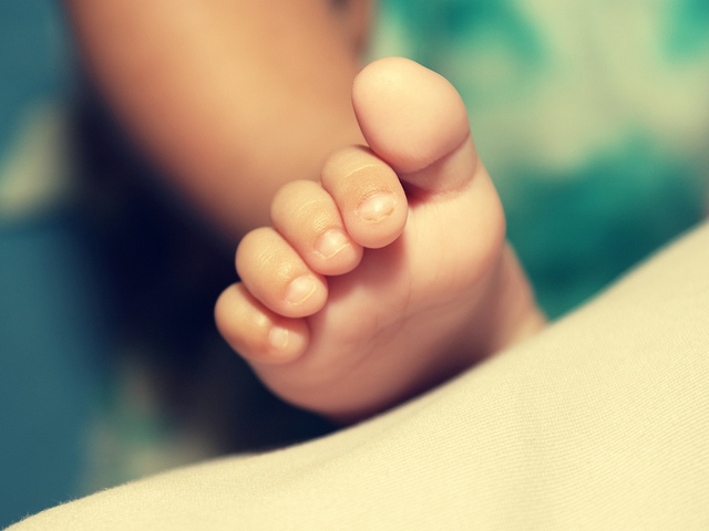 穿鞋一族的文明病 – 拇趾外翻