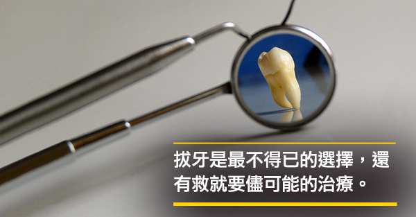 決定「拔牙」後植牙，必須要三思