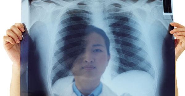 找出關鍵基因   掌握肺癌治療黃金期 