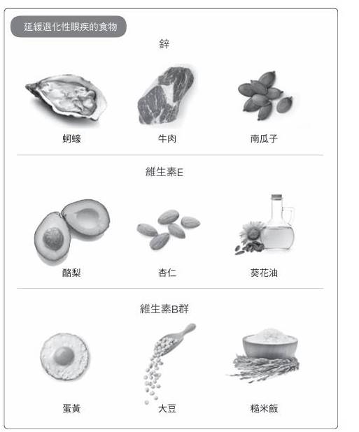 .退化性眼疾