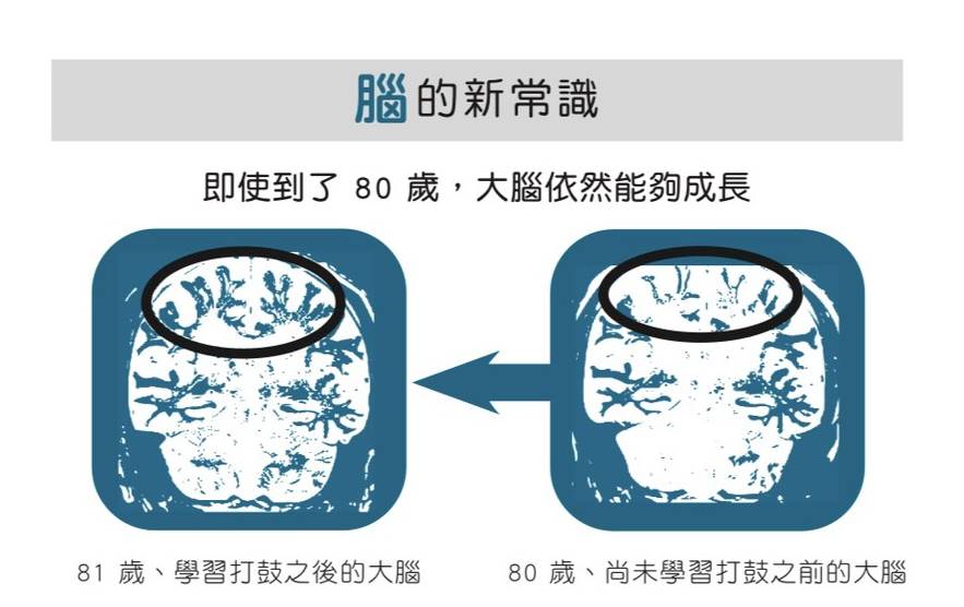 大腦